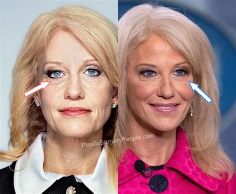 5 Ways Kellyanne Conway Faces 2024
