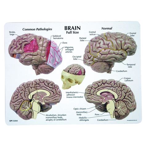 5 Ways Brain Model Works